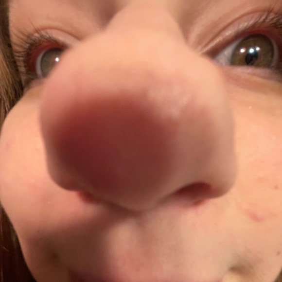skinscreamk
